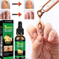Tratamiento para Hongos en Uñas – Pies y Manos (30 ml)